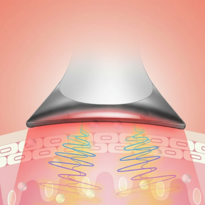 Skinule Branded Therapy Diagram